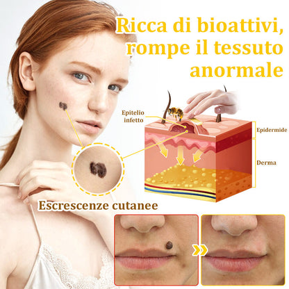 ✨flysmus™ Crema al Veleno d'Api per Più Benefici🐝:Tratta Eczema, Psoriasi, Acne, Rosacea, Infezioni Fungine, Verruche